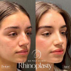 Artboard 70 copy (1)