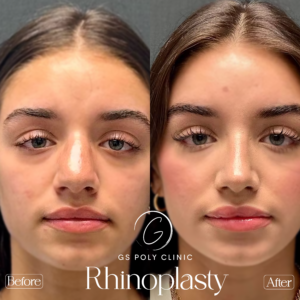 Artboard 70 copy 2 (1)