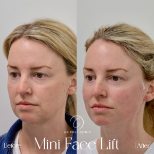 Artboard 70 copy 2 (2)