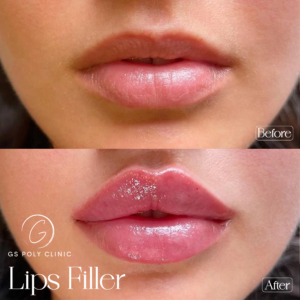 Artboard 70 copy 2 (3)