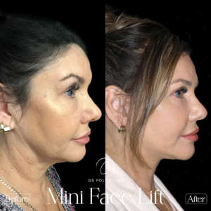 Artboard 70 copy (2)