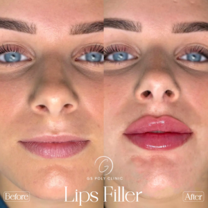 Artboard 70 copy 2 (4)