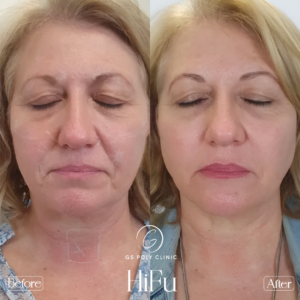 Artboard 70 copy 2 (7)