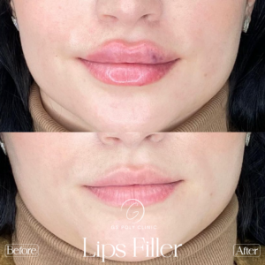 Artboard 70 copy 3 (1)