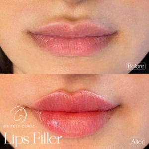 Artboard 70 copy (3)