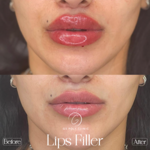 Artboard 70 copy (4)