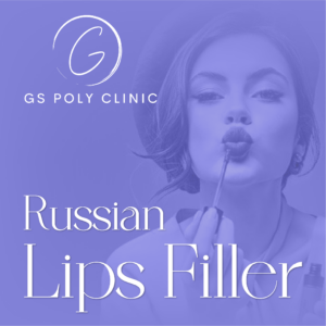 russian-lips-filler